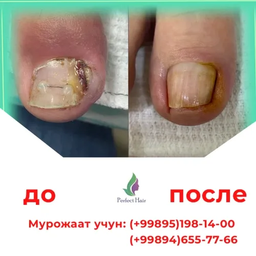 Фото слайдера: Perfect Hair