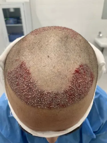 Фото слайдера: Perfect Hair