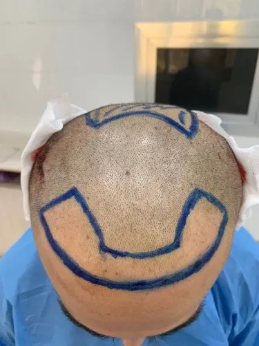 Фото слайдера: Perfect Hair