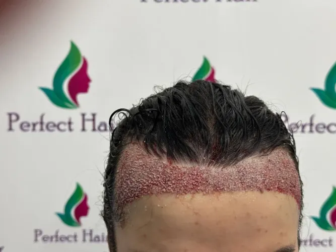 Фото слайдера: Perfect Hair