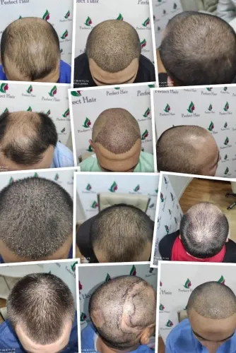 Фото слайдера: Perfect Hair