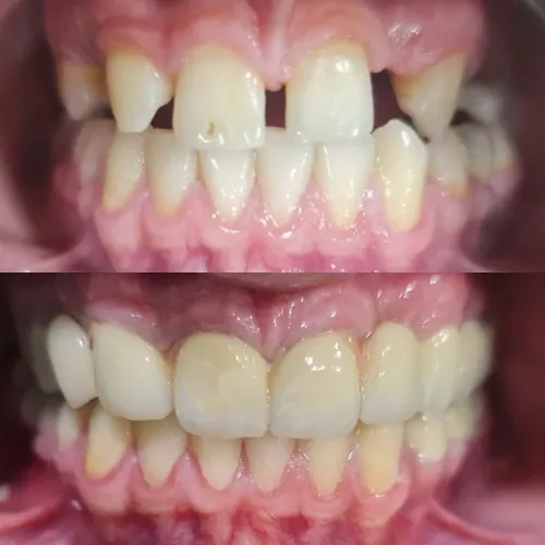 Slayder fotosurati: Dentcare dental clinic
