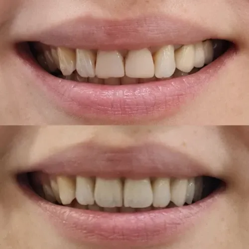 Slayder fotosurati: Dentcare dental clinic