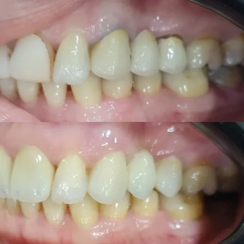 Slayder fotosurati: Dentcare dental clinic