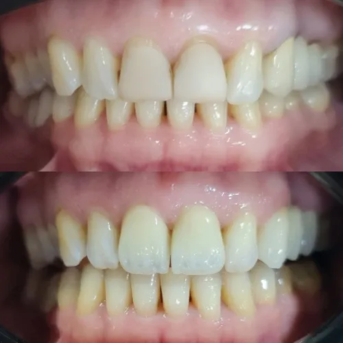 Slayder fotosurati: Dentcare dental clinic