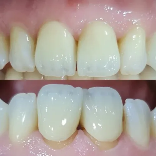 Slayder fotosurati: Dentcare dental clinic