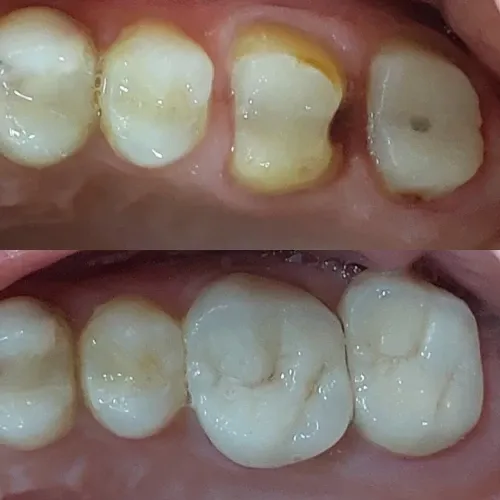 Slayder fotosurati: Dentcare dental clinic