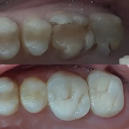 Slayder fotosurati: Dentcare dental clinic