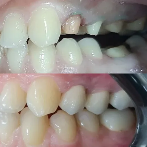 Slayder fotosurati: Dentcare dental clinic