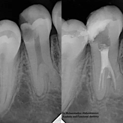 Slayder fotosurati: Dentcare dental clinic