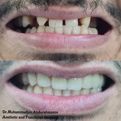 Slayder fotosurati: Dentcare dental clinic