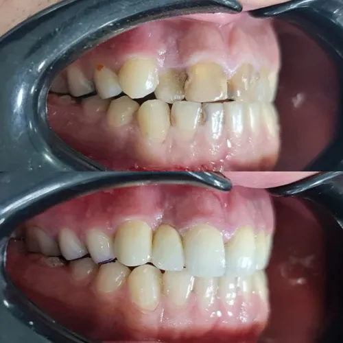 Slayder fotosurati: Dentcare dental clinic