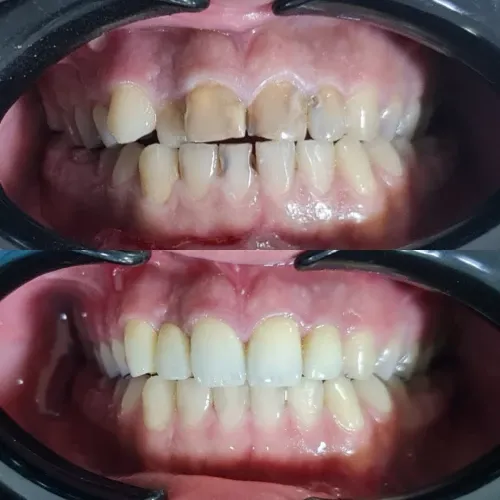 Slayder fotosurati: Dentcare dental clinic