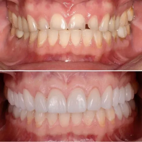 Slayder fotosurati: Dentcare dental clinic