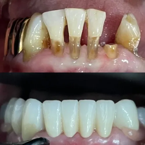 Slayder fotosurati: Dentcare dental clinic