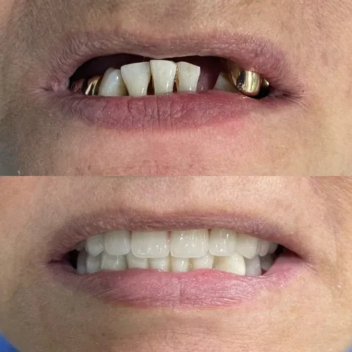 Slayder fotosurati: Dentcare dental clinic